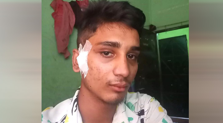 Teen injured in July Uprising dies after months of battle 