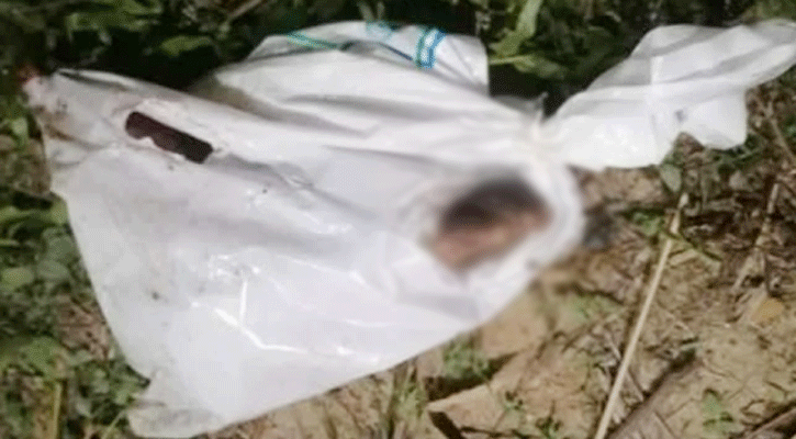 রামুতে পলিথিনে মোড়ানো ছিল মানুষের বিচ্ছিন্ন পা 